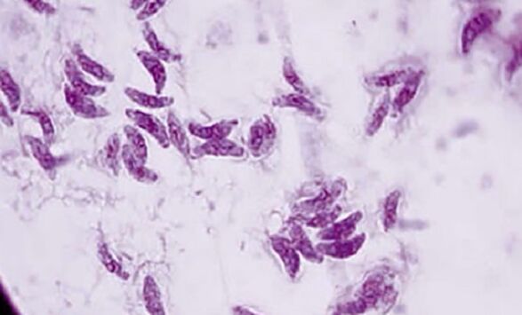 protozoan parasite toxoplasma gondii the causative agent of toxoplasmosis