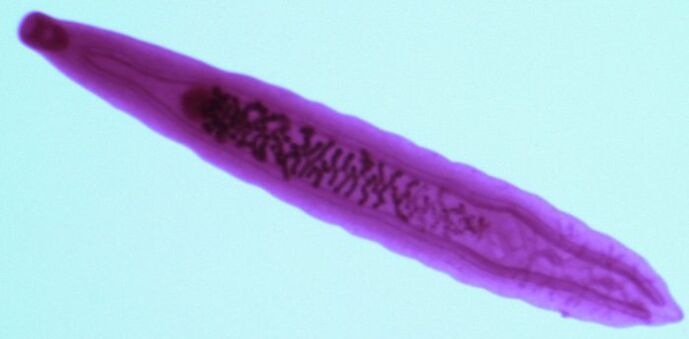 fluke parasite from the human body