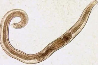 human parasites pinworm